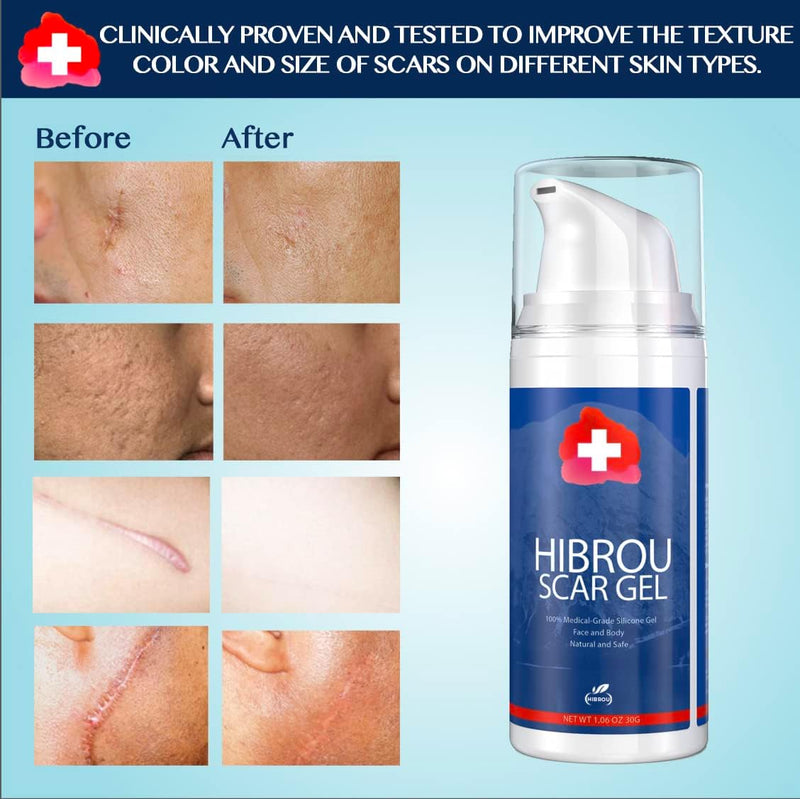 Scar Gel Silicone Scar Reducing Treatment Gel, 1.06 oz