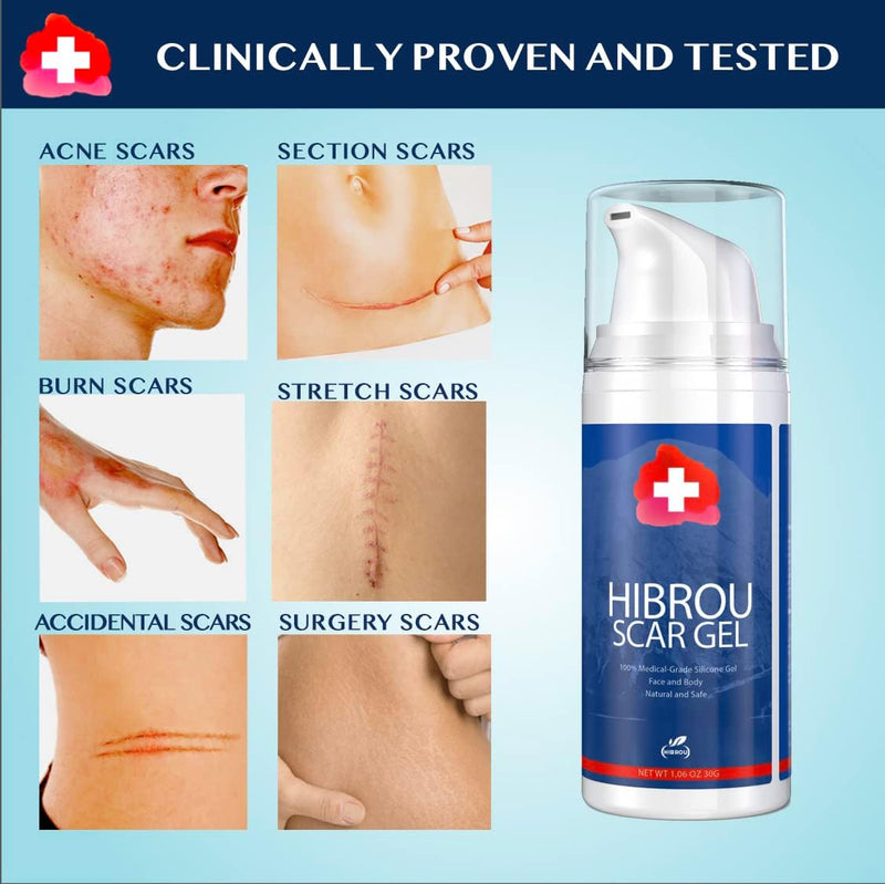 Scar Gel Silicone Scar Reducing Treatment Gel, 1.06 oz