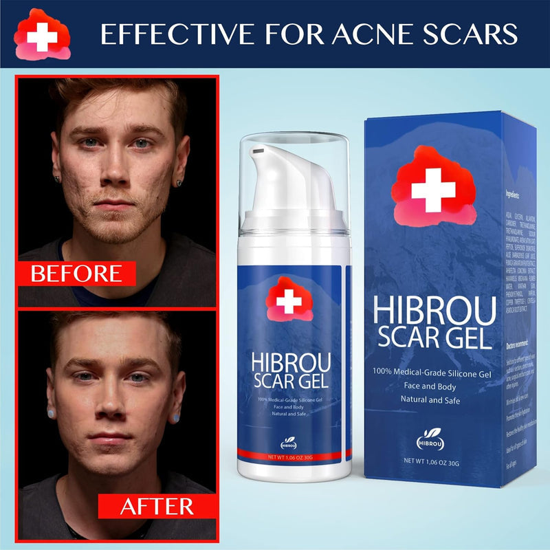 Scar Gel Silicone Scar Reducing Treatment Gel, 1.06 oz