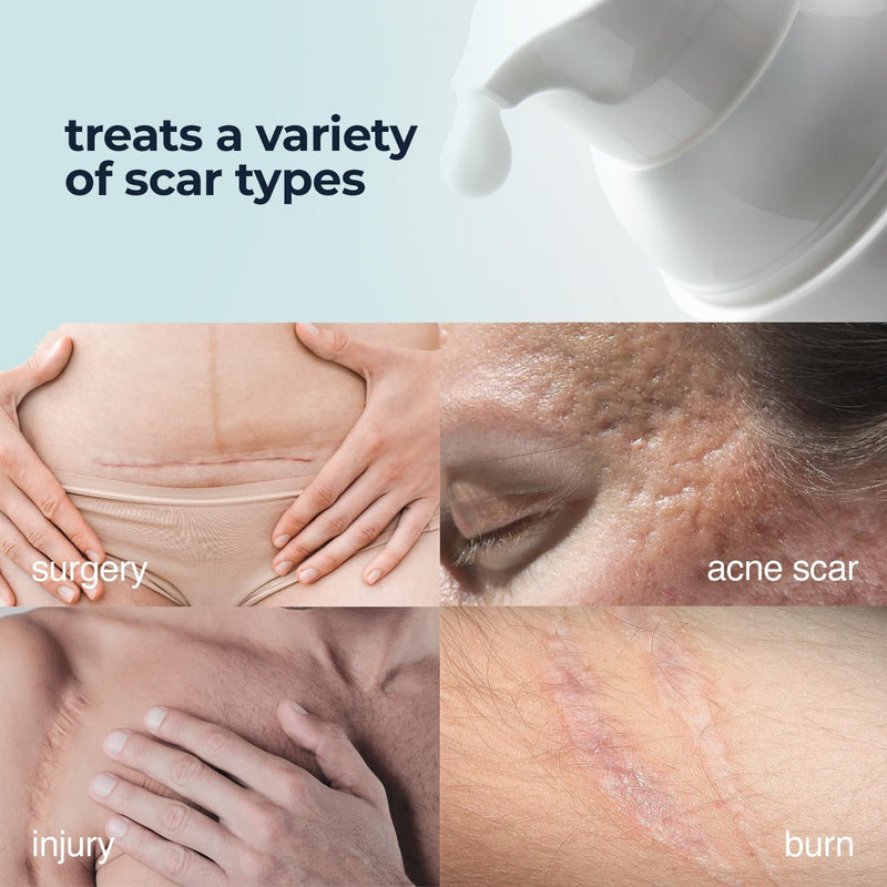 Silicone Scar Cream for Surgical and Bug Bite Scar Remover 0.73 Fl Oz - Scar Cream for New & Old Scars, C-Section and Burns - Vitamin E, Retinol and Allantoin