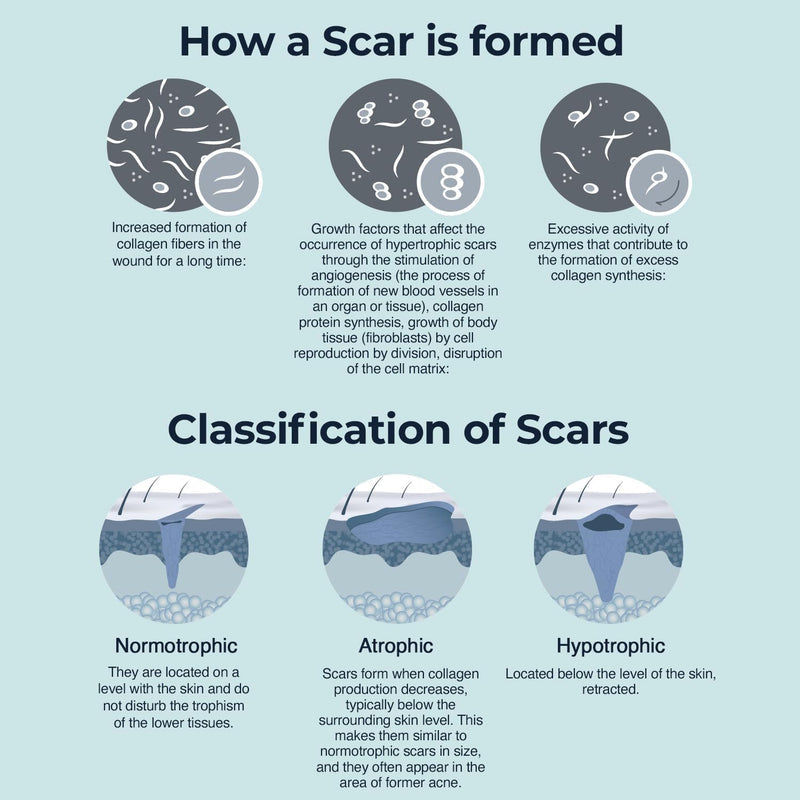 Silicone Scar Cream for Surgical and Bug Bite Scar Remover 0.73 Fl Oz - Scar Cream for New & Old Scars, C-Section and Burns - Vitamin E, Retinol and Allantoin