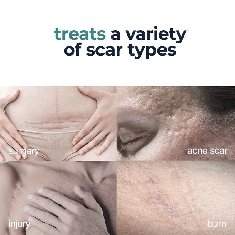 Advanced Scar Gel -Extract Aloe-Silicone Gel for Scars-New Old Scars for Surgical Scars,Stretch Marks,Burn,Keloid,C-Section,Acne, 1oz (30g)