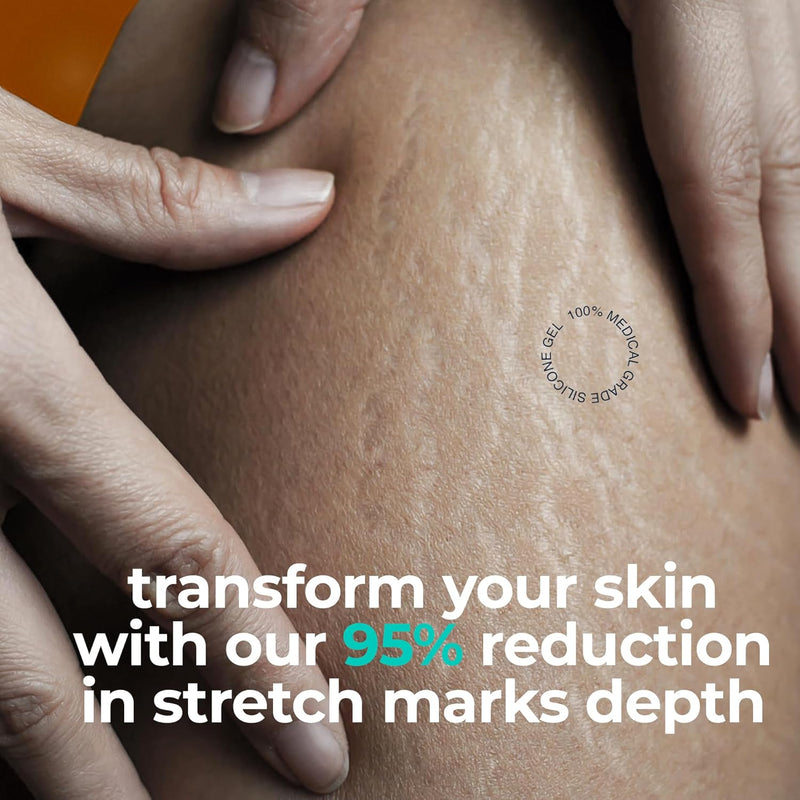 Advanced Scar Gel -Extract Aloe-Silicone Gel for Scars-New Old Scars for Surgical Scars,Stretch Marks,Burn,Keloid,C-Section,Acne, 1oz (30g)