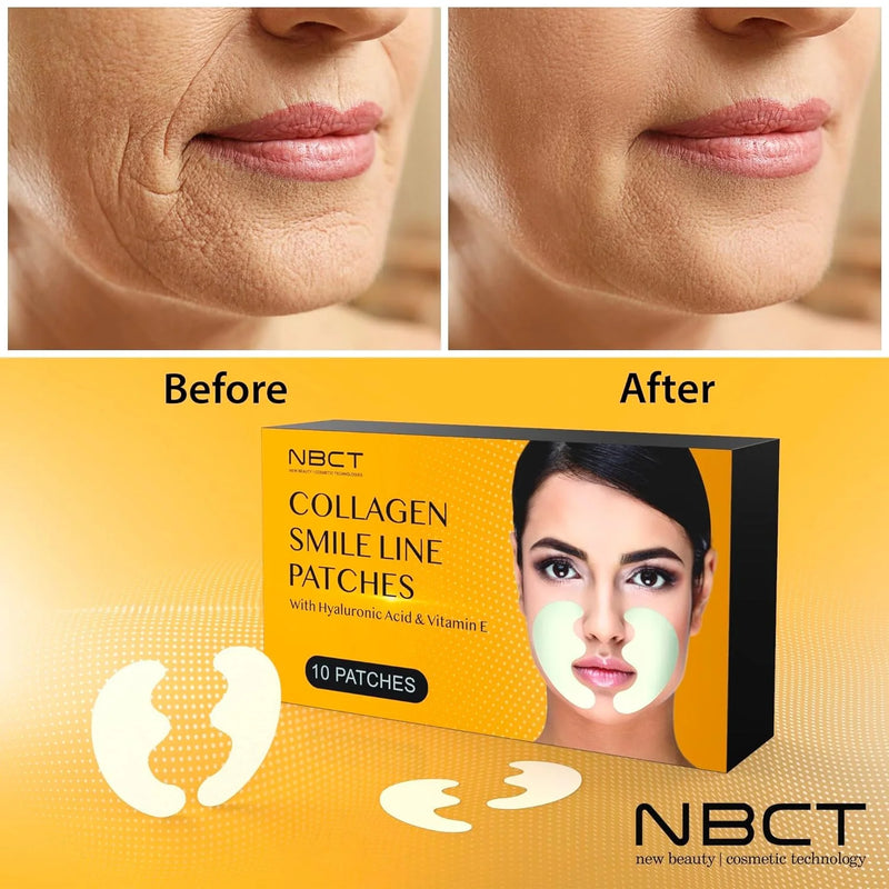 Collagen Smile Line Wrinkle Patches with Hyaluronic Acid, Deep hydration, Anti Aging, Aloe Vera, Vitamin E, Skin Safe & Botox Alternative - 5 pairs